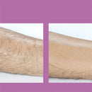 SmoothTouch – Depilador Sem Dor – Depilação Confortável e Rápida